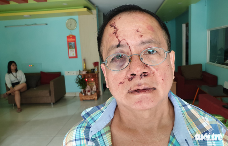 Một Việt kiều Đức bị nhóm thanh niên đánh tại quán karaoke ở TP.HCM - Ảnh 2.