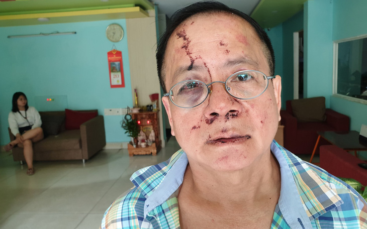 Một Việt kiều Đức bị nhóm thanh niên đánh tại quán karaoke ở TP.HCM