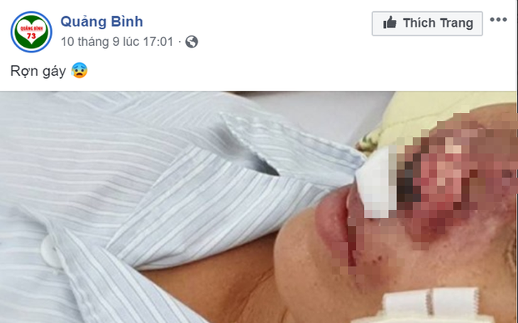 Quảng Bình bác tin đồn có bệnh nhân nhiễm 