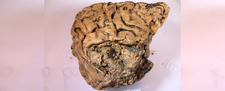 Phát hiện khoa học thú vị: Mô não người vẫn ‘còn nguyên’ sau 2.600 năm - Ảnh 1.