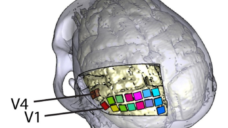 Nghiên cứu mới: Cấy điện cực khôi phục thị lực cho người mù - Ảnh 1.