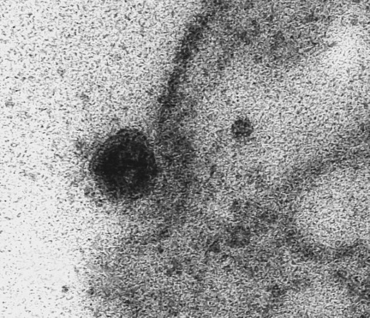 Lần đầu ghi được khoảnh khắc virus corona tấn công tế bào - Ảnh 2.