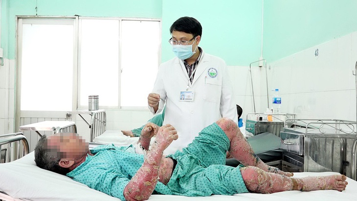 Bôi thuốc dân tộc vô, toàn thân sưng vù, nứt da, đóng vảy... - Ảnh 1.