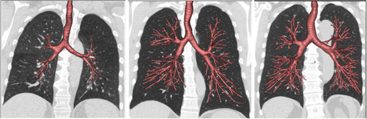 Nguyên nhân người không hút thuốc vẫn mắc bệnh phổi tắc nghẽn mãn tính - Ảnh 1.