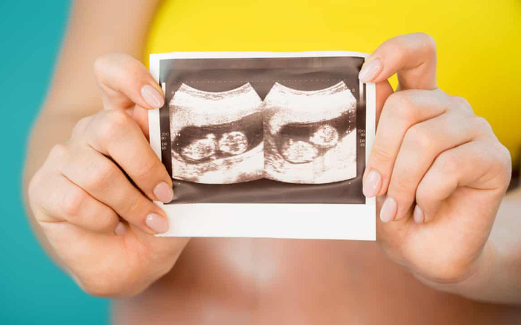 Một phụ nữ mang song thai trong 2 tử cung khác nhau, tỉ lệ 1/50 triệu