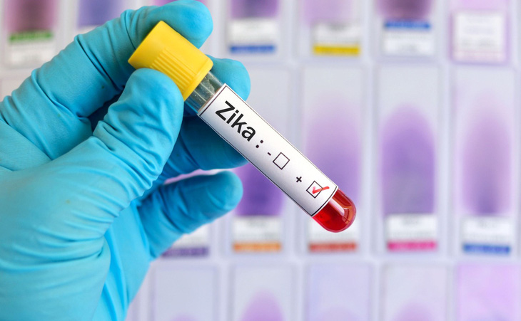 Brazil phát hiện chủng mới của virus zika có thể gây dịch - Ảnh 1.