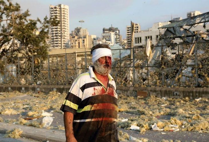Nổ lớn ở Lebanon, ít nhất 78 người thiệt mạng và gần 4.000 người bị thương - Ảnh 4.
