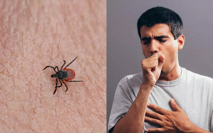 Virus lây từ bọ ve cắn làm 7 người chết, 60 người nhiễm bệnh tại Trung Quốc