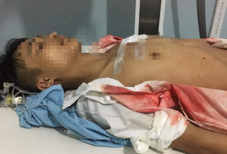 Hà Giang: Điều tra vụ việc một học sinh bị đâm tại cổng trường - Ảnh 1.