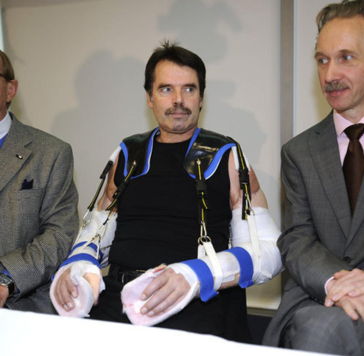 Bệnh nhân đầu tiên trên thế giới được ghép hai cánh tay và hai vai - Ảnh 3.