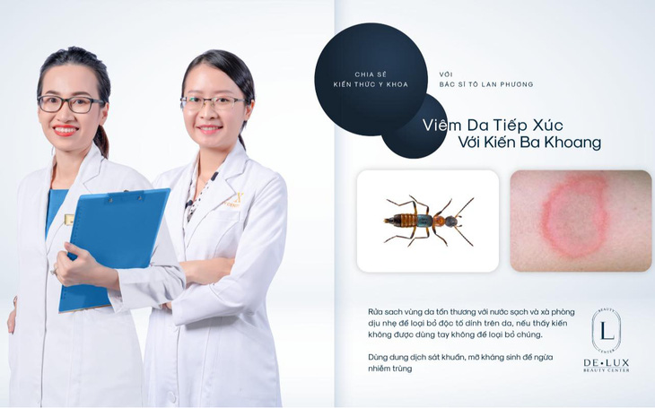 Bác sĩ Tô Lan Phương chia sẻ cách xử trí viêm da tiếp xúc với kiến ba khoang - Ảnh 1.