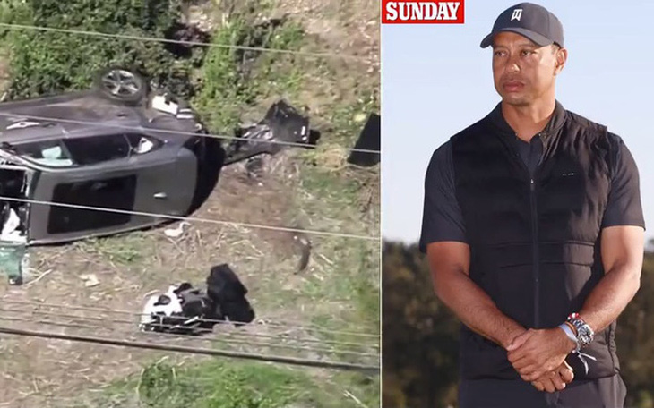 Tai nạn xe hơi nghiêm trọng, Tiger Woods bị giập nát cả hai cẳng chân - Ảnh 1.