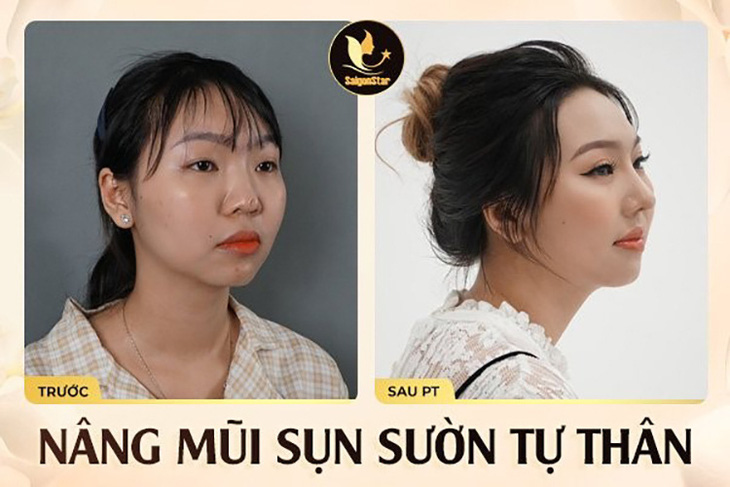 Bác sĩ Nguyễn Hữu Hoạt - chuyên gia phục hồi mũi hỏng nổi tiếng tại TP.HCM - Ảnh 4.