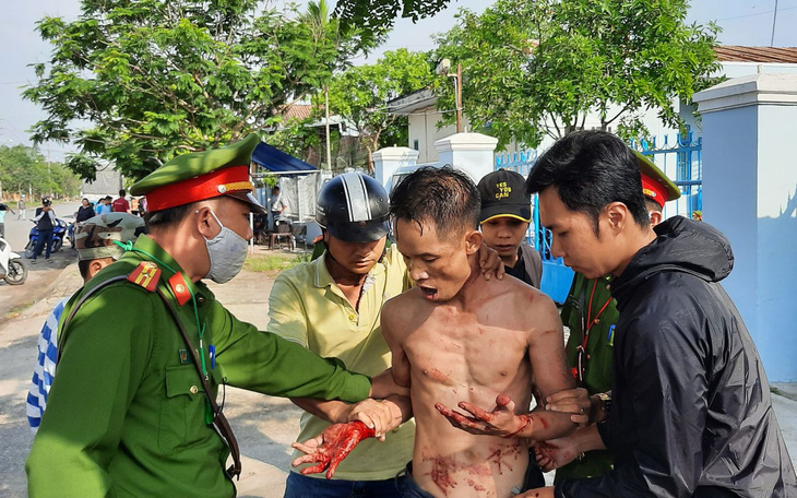 Khống chế người đàn ông vừa ra tù ‘ngáo đá’ cầm dao tự cắt tay, cổ mình