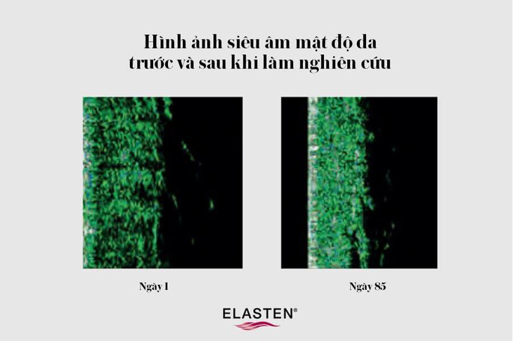 ELASTEN® Việt Nam - Khám phá hiệu quả trẻ hóa làn da theo chuẩn Đức - Ảnh 1.