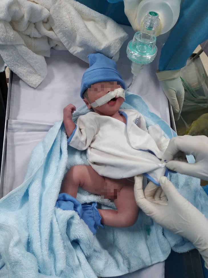 Bé trai kháu khỉnh nặng 2kg chào đời trong phòng hồi sức điều trị COVID-19 - Ảnh 1.