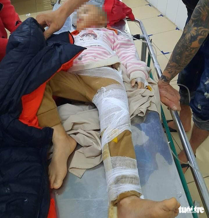 Sạt lở đất giữa khuya ở Hà Tĩnh, một cháu bé bị gãy chân khi đang ngủ - Ảnh 2.