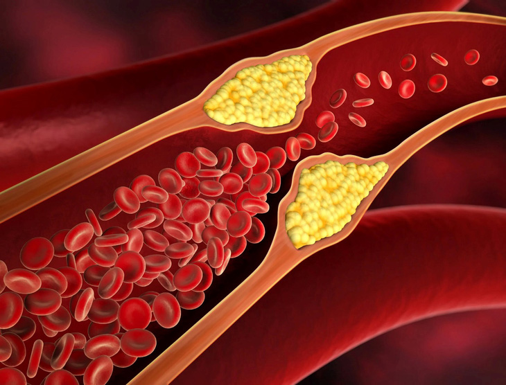 Các phát hiện mới liên quan tới lượng cholesterol trong máu - Ảnh 1.