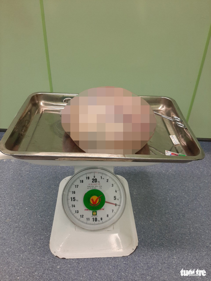 Mang khối u buồng trứng 6kg, người phụ nữ 66 tuổi nghĩ… mỡ bụng - Ảnh 2.