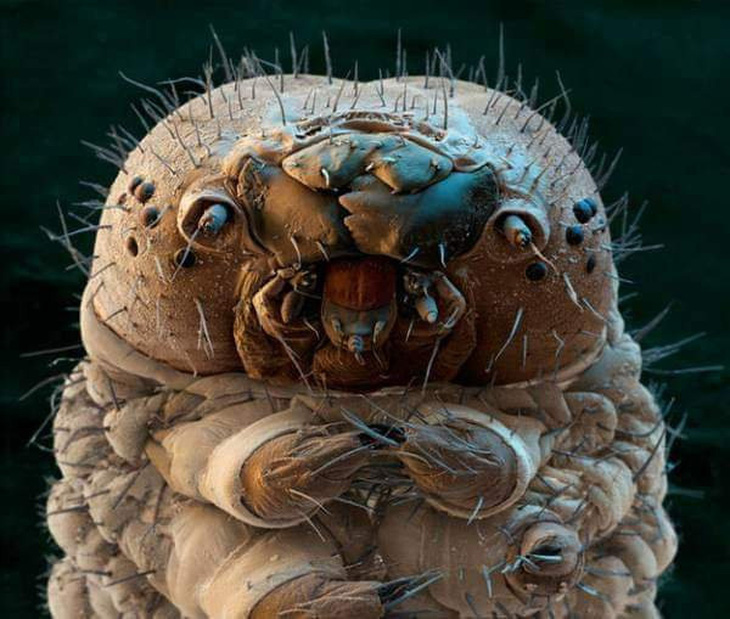 Bạn có biết: Dưới da mặt bạn, hàng trăm con nhện siêu nhỏ ung dung sống? - Ảnh 3.