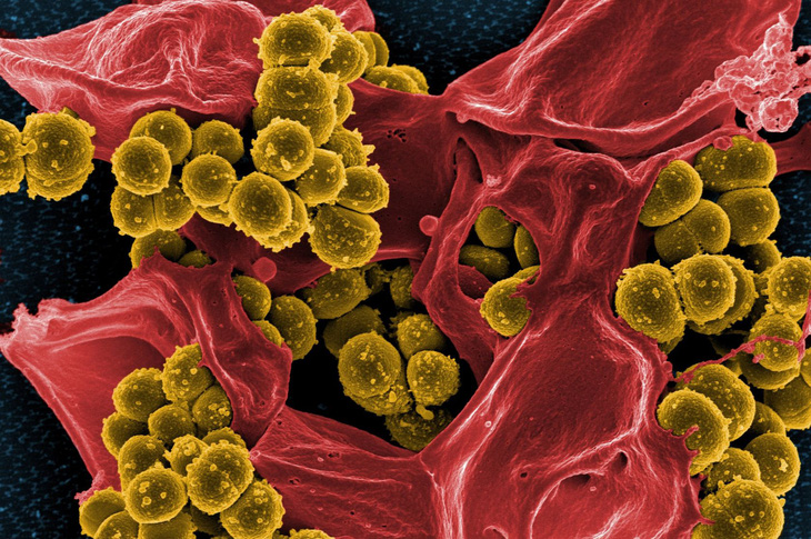 Cảnh báo về siêu vi khuẩn kháng kháng sinh từ lợn lây sang người - Ảnh 1.