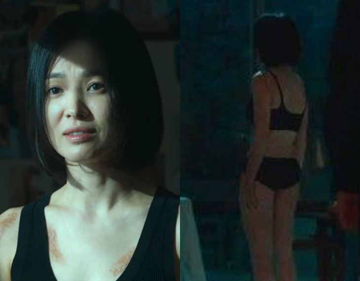 Cởi áo lộ cơ thể đầy sẹo, Song Hye Kyo bị chê bai sắc vóc - Ảnh 6.