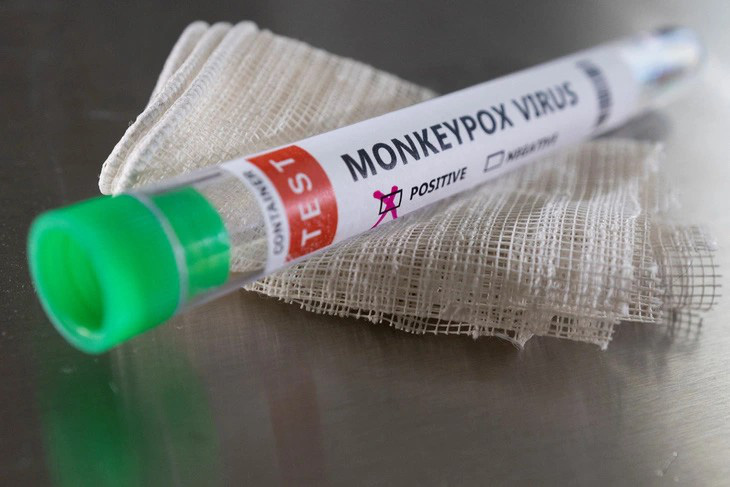 Theo hướng dẫn của Bộ Y tế, bệnh đậu mùa khỉ được chẩn đoán qua xét nghiệm sinh học phân tử (PCR hoặc tương đương) - Ảnh: AFP