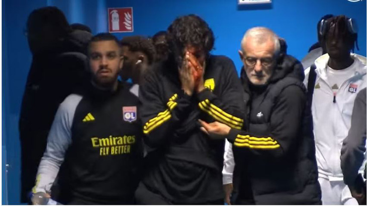 Huấn luyện viên Fabio Grosso bị thương trong vụ cổ động viên ném đá xe buýt chở đội Lyon - Ảnh: Prime
