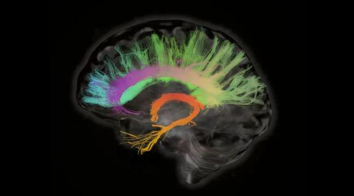 Bức ảnh chụp X-quang đầy màu sắc của não người - Ảnh; SHERBROOKE CONNECTIVITY IMAGING LAB  