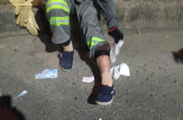 Vết thương trên chân chị Khải chảy nhiều máu lúc bị bắn - Ảnh: Công ty Môi trường cung cấp 