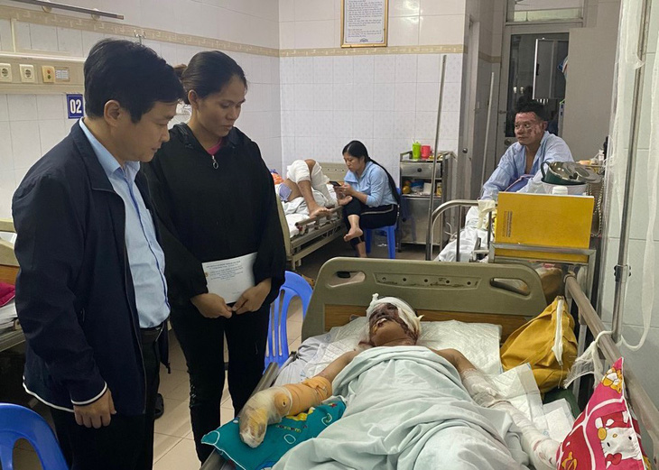 Công đoàn tỉnh Quảng Ngãi ra Bệnh viện Bỏng quốc gia thăm 6 công nhân đang điều trị tại đây - Ảnh: N.P.N.