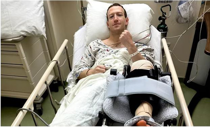 Mark Zuckerberg chia sẻ những bức ảnh từ bệnh viện sau khi trải qua ca phẫu thuật đầu gối - Ảnh: Instagram