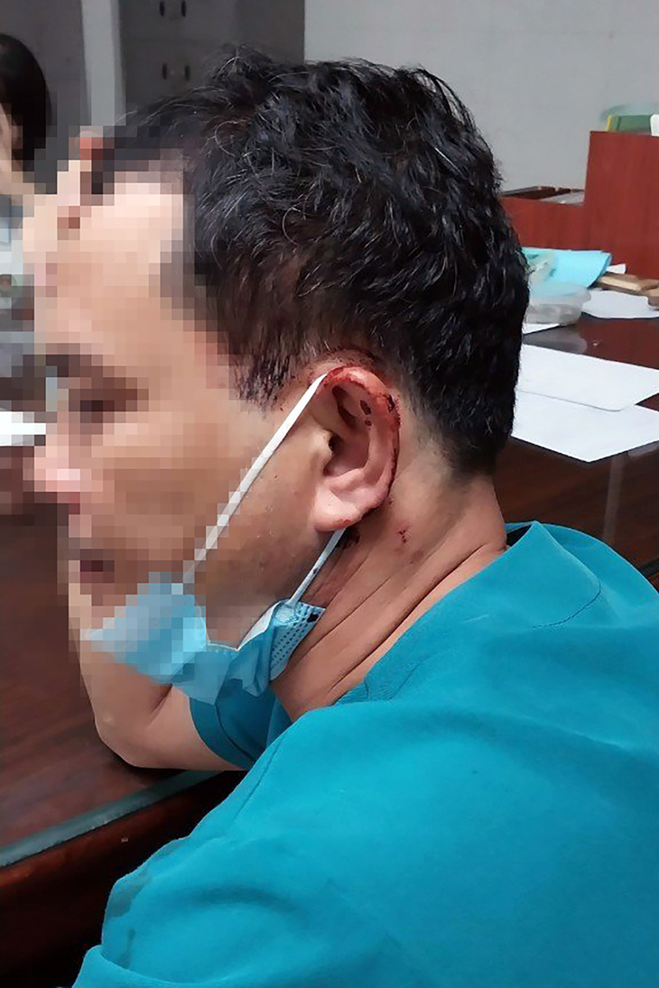 Anh Trương Ngọc Nghĩa, điều dưỡng thuộc Bệnh viện Đa khoa tỉnh Bình Phước, với vết thương ở đầu do người nhà bệnh nhân hành hung - Ảnh: AN BÌNH