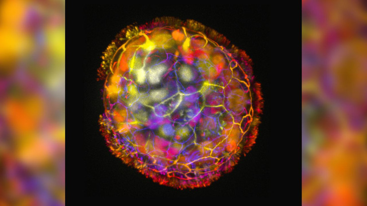 Một hình ảnh màu cho thấy cấu trúc đa bào của anthrobot, được bao quanh bởi các lông mao trên bề mặt, cho phép nó di chuyển và khám phá môi trường xung quanh - Ảnh: TUFTS UNIVERSIY