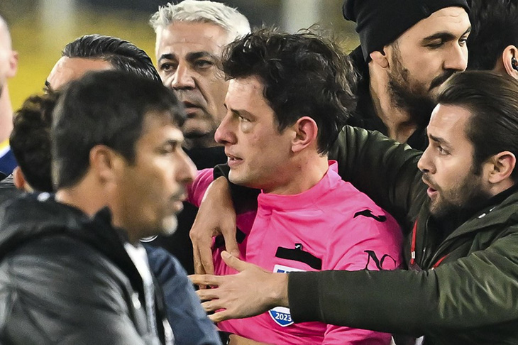 Một bên mắt của trọng tài Meler (áo hồng) bị sưng húp sau cú đấm của chủ tịch Koca - Ảnh: NTV Spor