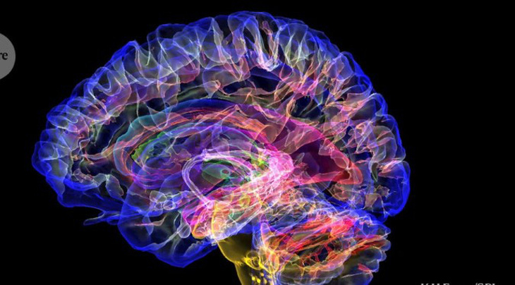 Quét MRI màu của bộ não con người khỏe mạnh. Khi não bị tổn thương, các mạch thần kinh liên quan đến nhận thức và trí nhớ cũng bị tổn thương.- Ảnh: NATURE