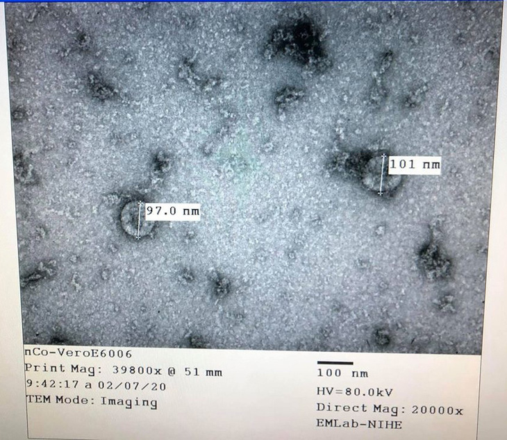 TP.HCM sẽ nuôi cấy vi rút SARS-CoV-2? - Ảnh 1.