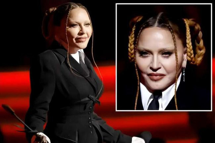 Xuất hiện với gương mặt biến dạng, Madonna bị netizen ‘cà khịa - Ảnh 2.