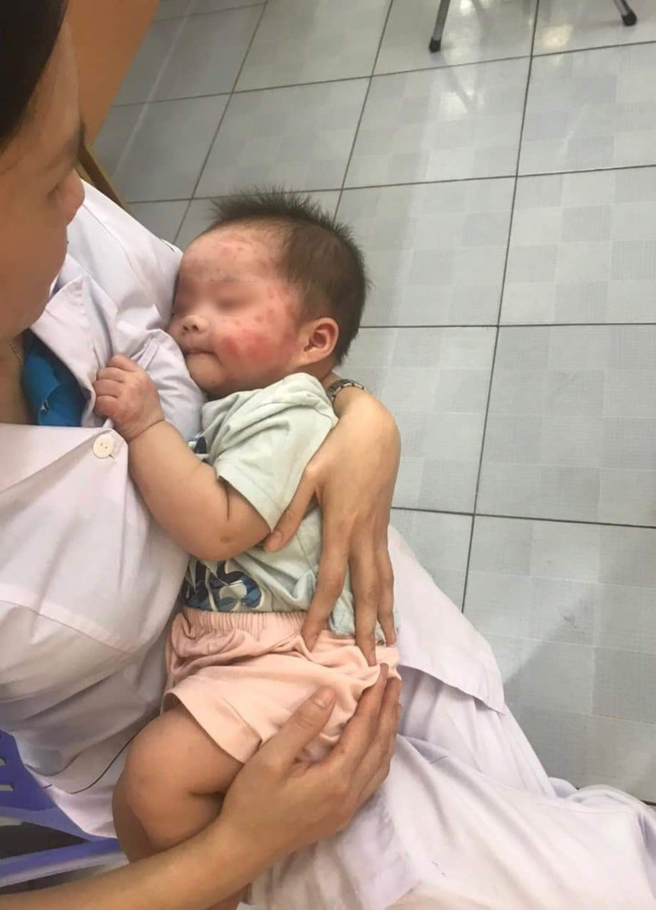 Bé gái khoảng 7 tháng tuổi được phát hiện bên vệ đường xã Hồng Thái Tây, thị xã Đông Triều, tỉnh Quảng Ninh trong tình trạng muỗi đốt sưng đỏ vùng mặt - Ảnh: Facebook Quảng Ninh 24/7 