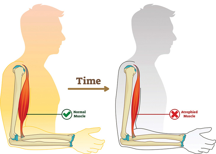 Bệnh hiếm ở trẻ em:  Bác sĩ và ba mẹ không buông tay - Ảnh 11.