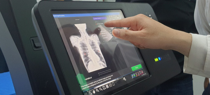 Bệnh nhân nhận kết quả X-quang chỉ sau vài giây nhờ AI - Ảnh 1.