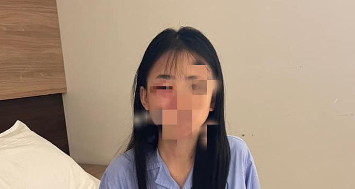 Nữ sinh lớp 8 ở Hà Nội bị đánh hội đồng phải nhập viện - Ảnh 1.