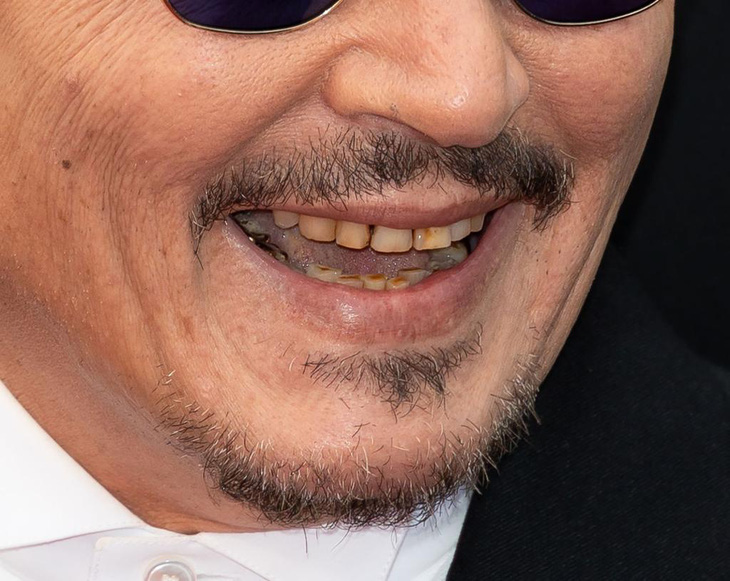 Fan ngán ngẩm với hàm răng mục nát của Johnny Depp - Ảnh 5.