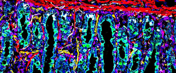 Bản đồ các tế bào trong ruột con người - Ảnh: STANFORD MEDICINE