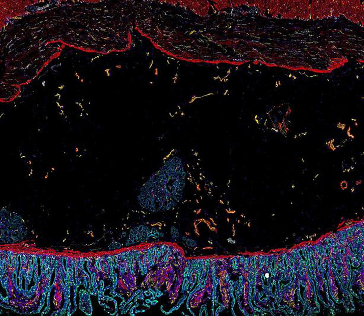 Các tế bào trong ruột bao quanh lẫn nhau - Ảnh: STANFORD MEDICINE