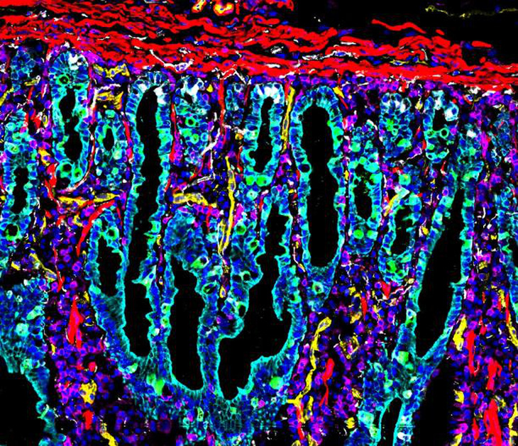 Bản đồ đầu tiên về ruột người - Ảnh: STANFORD MEDICINE