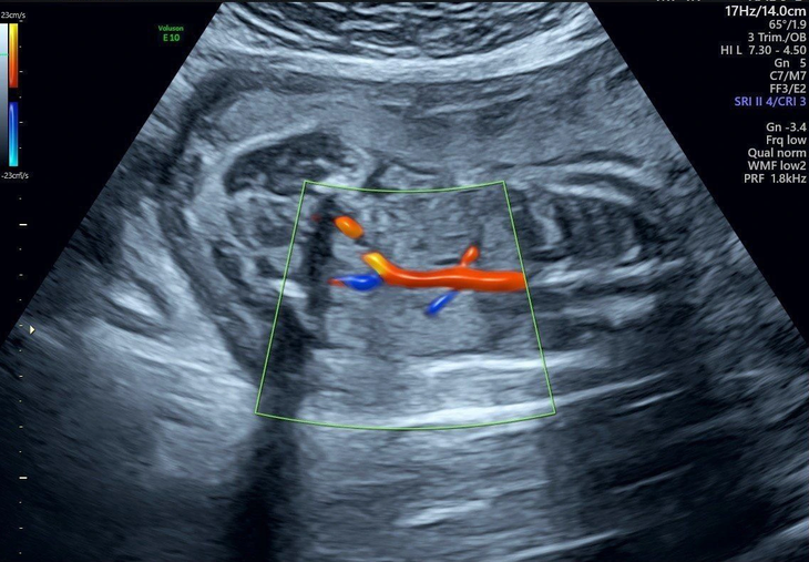 Hình ảnh siêu âm bất thường của thai nhi - Ảnh: Bác sĩ cung cấp
