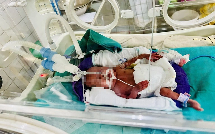 Hành trình lớn lên kỳ diệu của bé gái sinh non 22 tuần, nhẹ cân nhất Việt Nam