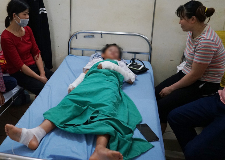 Một học sinh Trường tiểu học Yên Phú bị bỏng do nổ bóng bay, nằm điều trị vết bỏng tại Bệnh viện Đa khoa huyện Yên Định ngày 5-9 - Ảnh: CTV