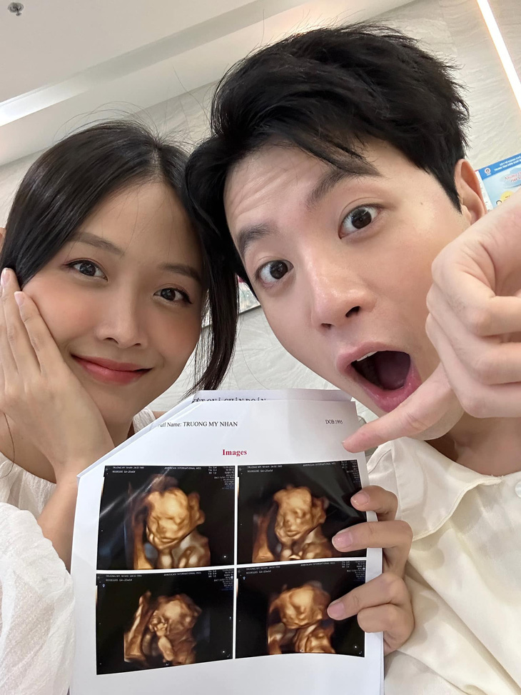 Vợ chồng Trương Mỹ Nhân - Phí Ngọc Hưng khoe ảnh chụp con thứ hai sắp chào đời
